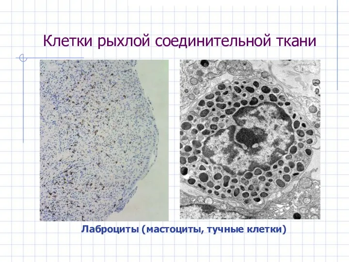 Клетки рыхлой соединительной ткани Лаброциты (мастоциты, тучные клетки)