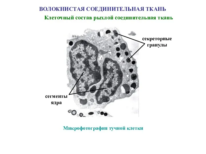 ВОЛОКНИСТАЯ СОЕДИНИТЕЛЬНАЯ ТКАНЬ Клеточный состав рыхлой соединительная ткань Микрофотография тучной клетки сегменты ядра секреторные гранулы