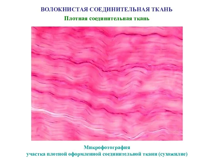 ВОЛОКНИСТАЯ СОЕДИНИТЕЛЬНАЯ ТКАНЬ Плотная соединительная ткань Микрофотография участка плотной оформленной соединительной ткани (сухожилие)