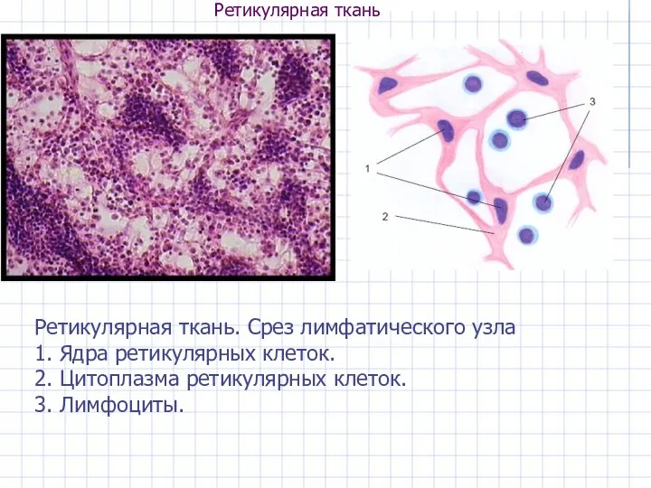 Ретикулярная ткань Ретикулярная ткань. Срез лимфатического узла 1. Ядра ретикулярных клеток. 2. Цитоплазма