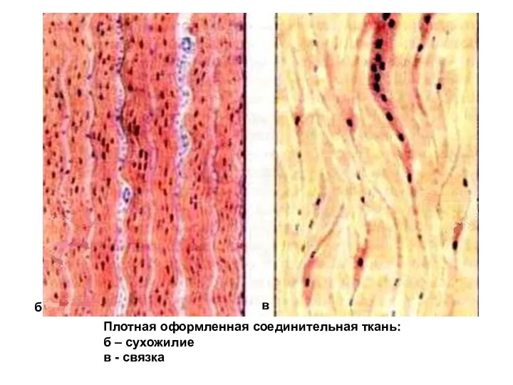 Плотная оформленная соединительная ткань: б – сухожилие в - связка б в