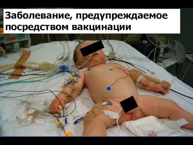 Vaccine preventable disease Заболевание, предупреждаемое посредством вакцинации