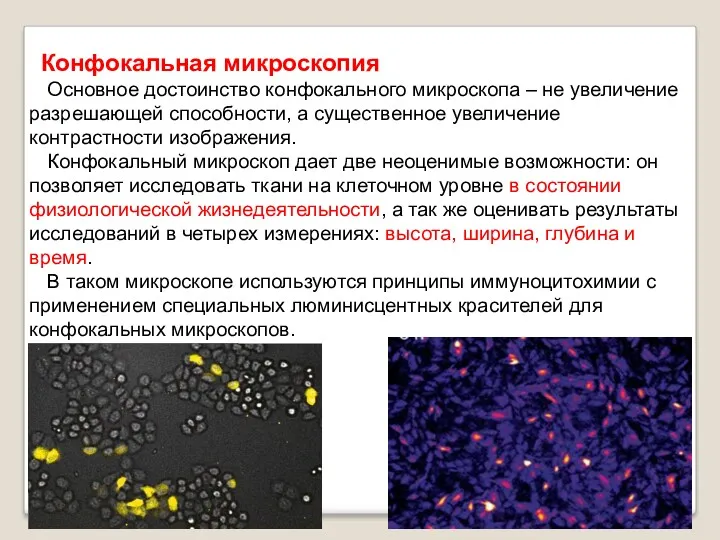 Конфокальная микроскопия Основное достоинство конфокального микроскопа – не увеличение разрешающей