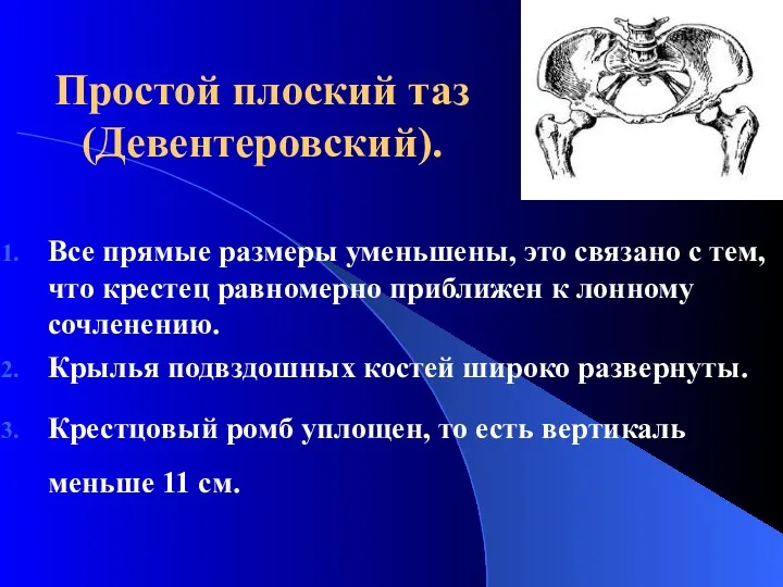 Простой плоский таз (Девентеровский). Все прямые размеры уменьшены, это связано