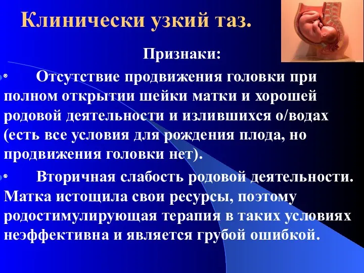 Клинически узкий таз. Признаки: ∙ Отсутствие продвижения головки при полном