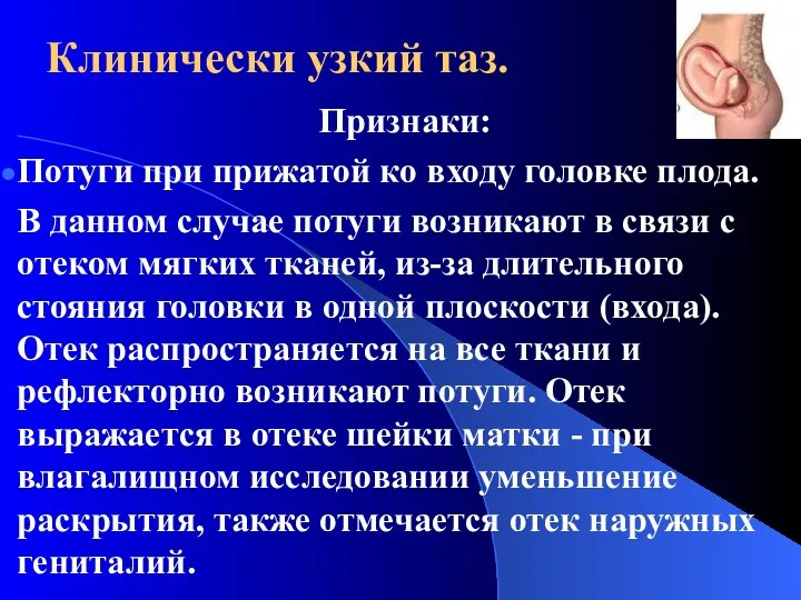 Клинически узкий таз. Признаки: Потуги при прижатой ко входу головке