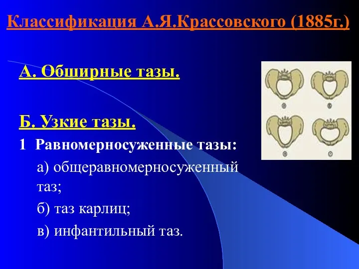 Классификация А.Я.Крассовского (1885г.) А. Обширные тазы. Б. Узкие тазы. 1