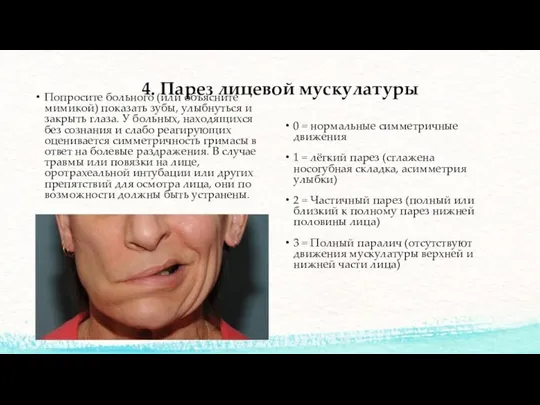 4. Парез лицевой мускулатуры Попросите больного (или объясните мимикой) показать зубы, улыбнуться и