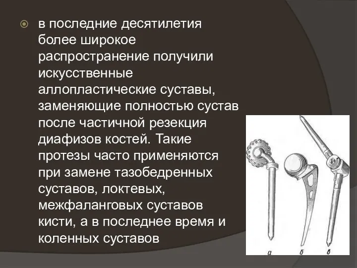 в последние десятилетия более широкое распространение получили искусственные аллопластические суставы, заменяющие полностью сустав