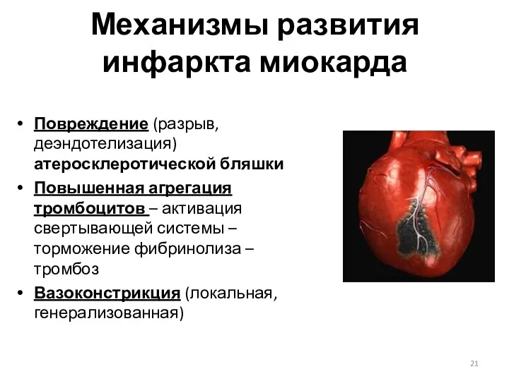 Механизмы развития инфаркта миокарда Повреждение (разрыв, деэндотелизация) атеросклеротической бляшки Повышенная агрегация тромбоцитов –