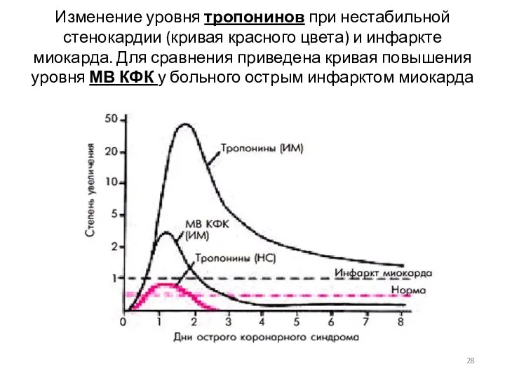 Изменение уровня тропонинов при нестабильной стенокардии (кривая красного цвета) и инфаркте миокарда. Для