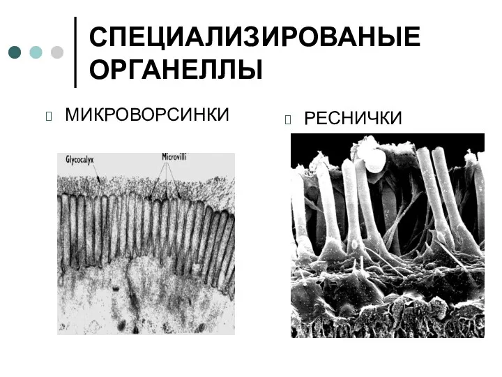 СПЕЦИАЛИЗИРОВАНЫЕ ОРГАНЕЛЛЫ МИКРОВОРСИНКИ РЕСНИЧКИ