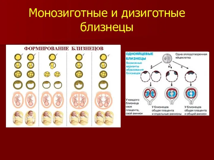 Монозиготные и дизиготные близнецы