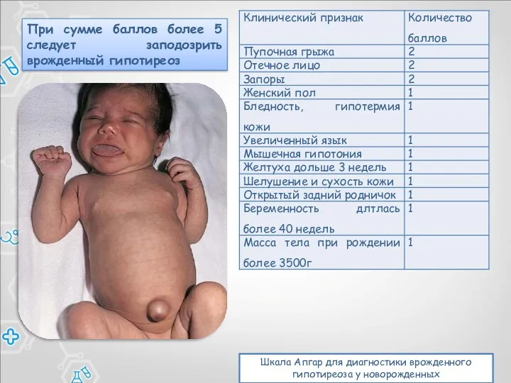 Шкала Апгар для диагностики врожденного гипотиреоза у новорожденных При сумме