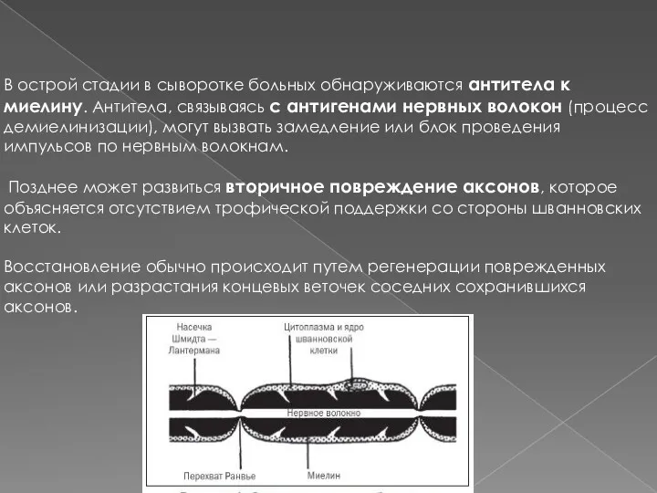 В острой стадии в сыворотке больных обнаруживаются антитела к миелину.