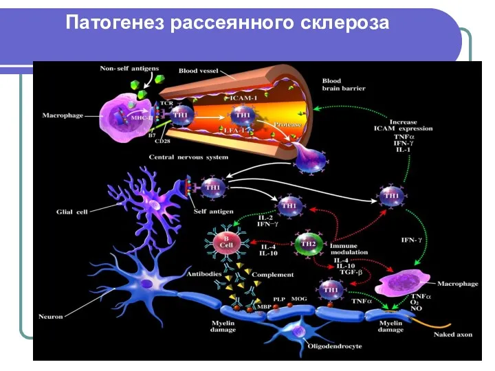 Патогенез рассеянного склероза