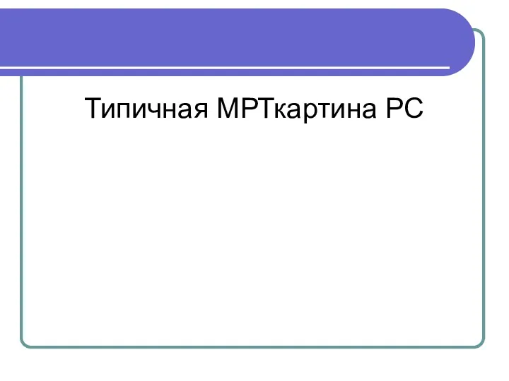 Типичная МРТкартина РС