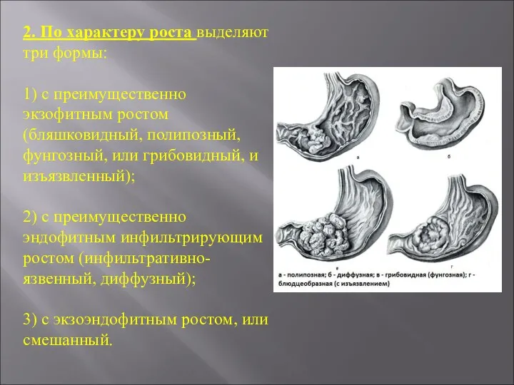 2. По характеру роста выделяют три формы: 1) с преимущественно экзофитным ростом (бляшковидный,