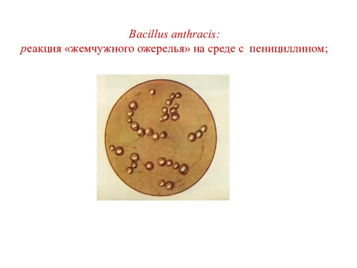 Bacillus anthracis: реакция «жемчужного ожерелья» на среде с пенициллином;