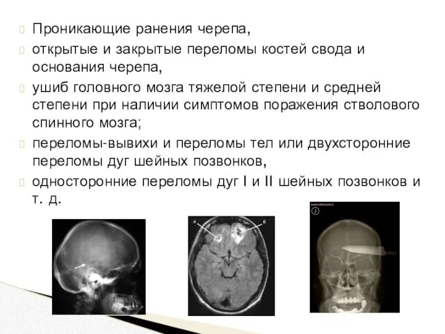 Проникающие ранения черепа, открытые и закрытые переломы костей свода и основания черепа, ушиб