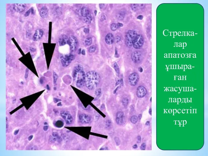 Стрелка-лар апатозға ұшыра-ған жасуша-ларды көрсетіп тұр