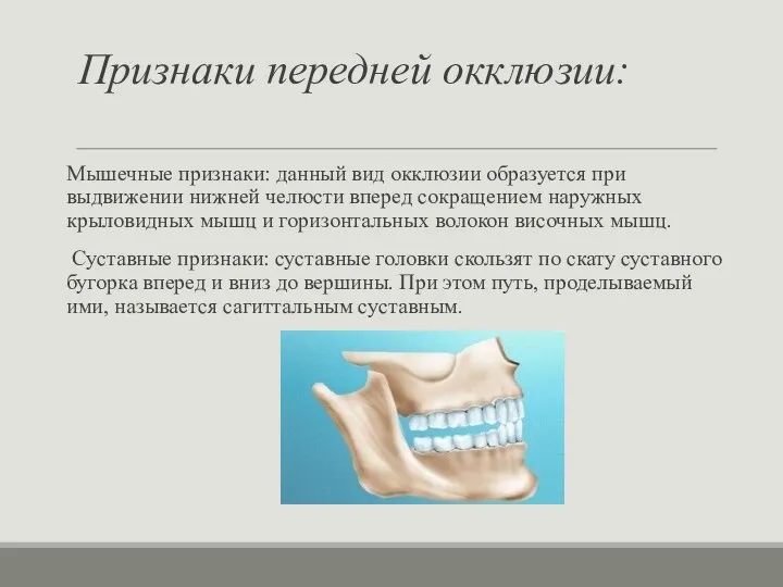 Признаки передней окклюзии: Мышечные признаки: данный вид окклюзии образуется при