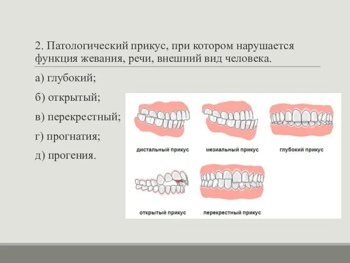 2. Патологический прикус, при котором нарушается функция жевания, речи, внешний