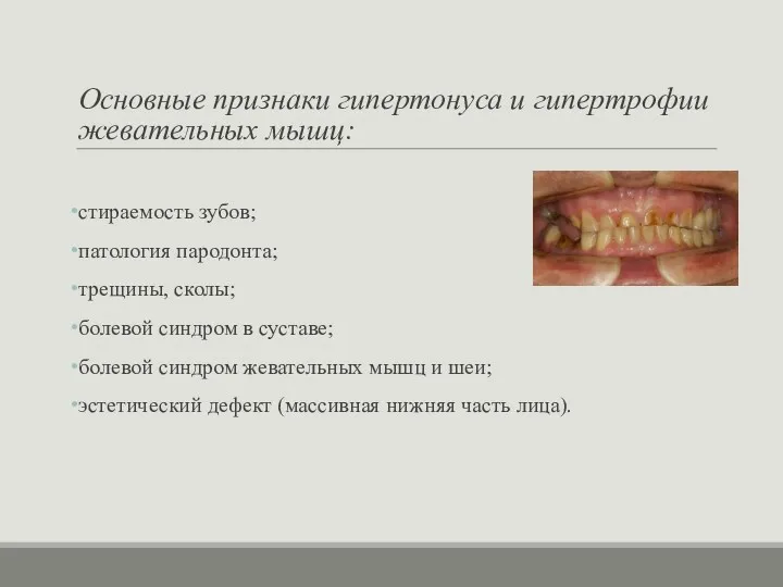 Основные признаки гипертонуса и гипертрофии жевательных мышц: стираемость зубов; патология