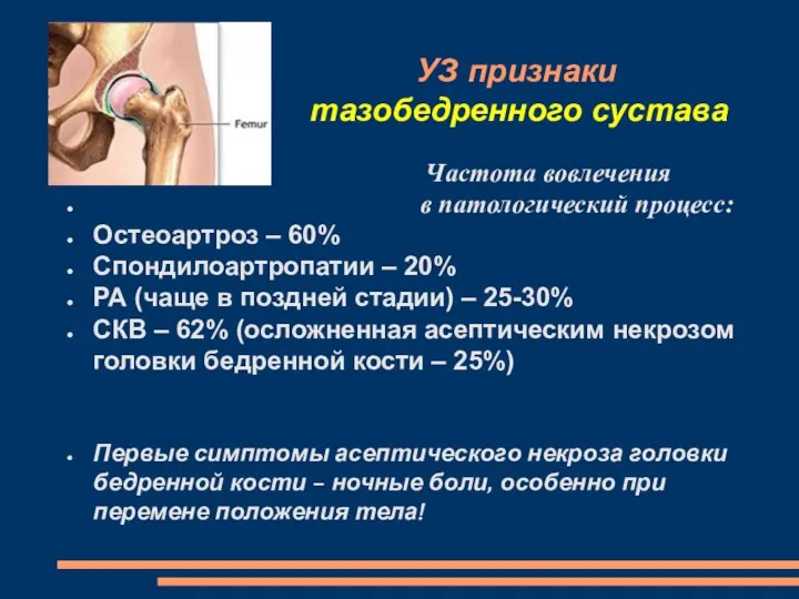 УЗ признаки тазобедренного сустава Частота вовлечения в патологический процесс: Остеоартроз