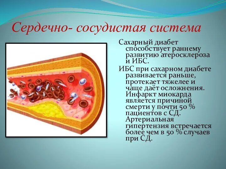 Сердечно- сосудистая система Сахарный диабет способствует раннему развитию атеросклероза и