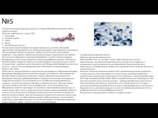 №5 Сперматозоиды морской свинки Окраска: железный гематоксилин Метод удобен тем,