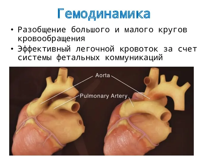 Гемодинамика Разобщение большого и малого кругов кровообращения Эффективный легочной кровоток за счет системы фетальных коммуникаций