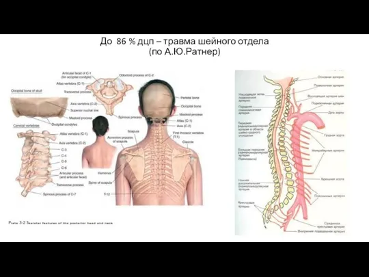 До 86 % дцп – травма шейного отдела (по А.Ю.Ратнер)