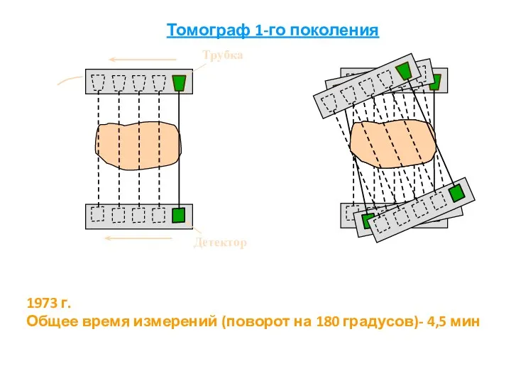 Томограф 1-го поколения 1973 г. Общее время измерений (поворот на 180 градусов)- 4,5 мин