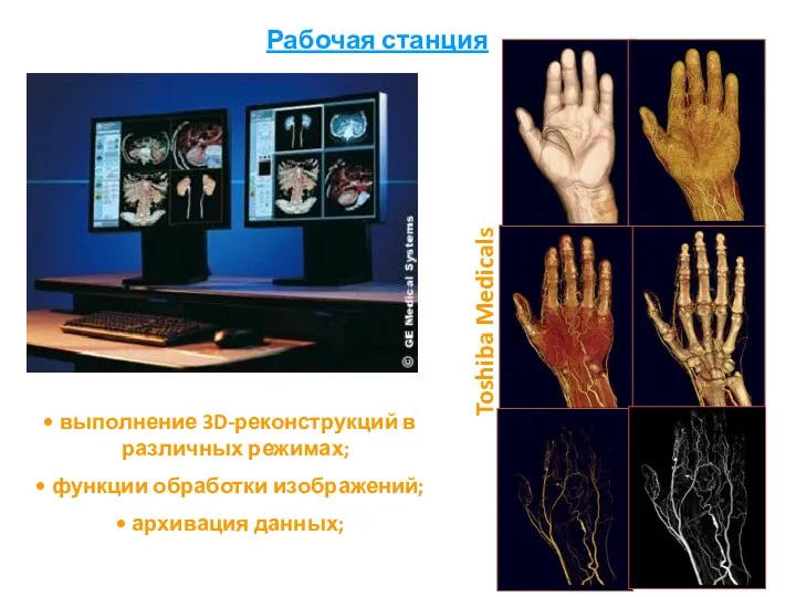 Рабочая станция выполнение 3D-реконструкций в различных режимах; функции обработки изображений; архивация данных; Toshiba Medicals