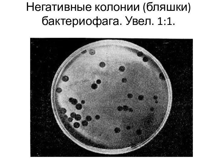 Негативные колонии (бляшки) бактериофага. Увел. 1:1.