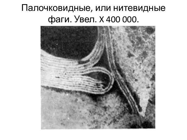 Палочковидные, или нитевидные фаги. Увел. X 400 000.