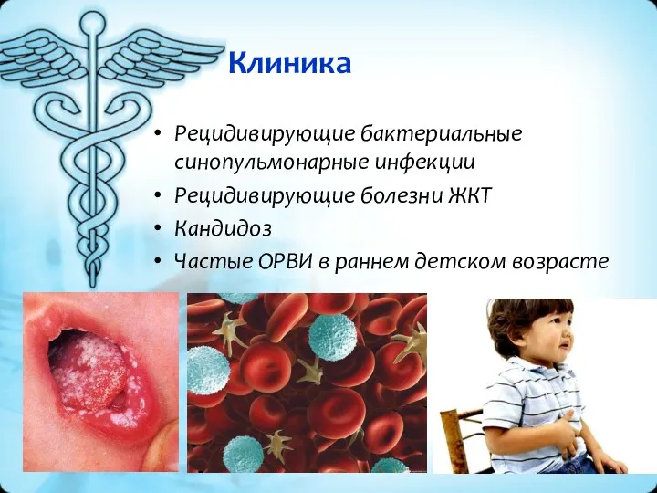 Клиника Рецидивирующие бактериальные синопульмонарные инфекции Рецидивирующие болезни ЖКТ Кандидоз Частые ОРВИ в раннем детском возрасте