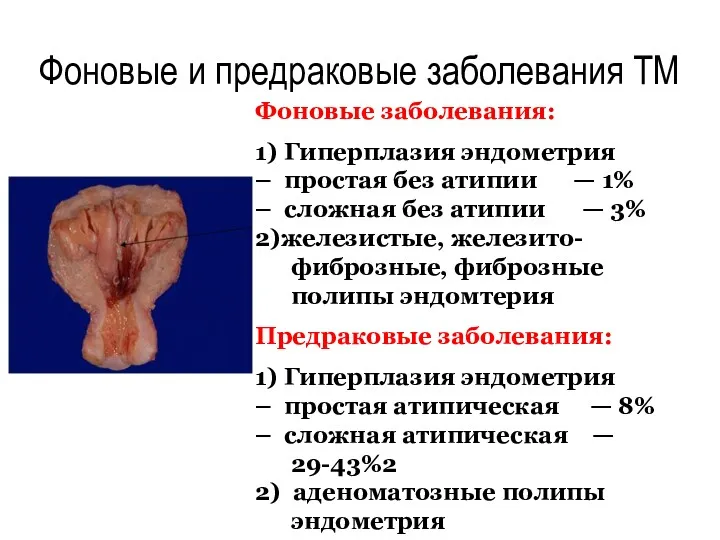 Фоновые заболевания: 1) Гиперплазия эндометрия – простая без атипии —