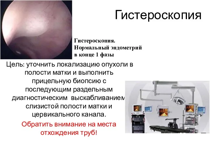 Гистероскопия Цель: уточнить локализацию опухоли в полости матки и выполнить