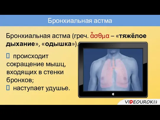 Бронхиальная астма Бронхиальная астма (греч. ἆσθμα – «тяжёлое дыхание», «одышка»). происходит сокращение мышц,