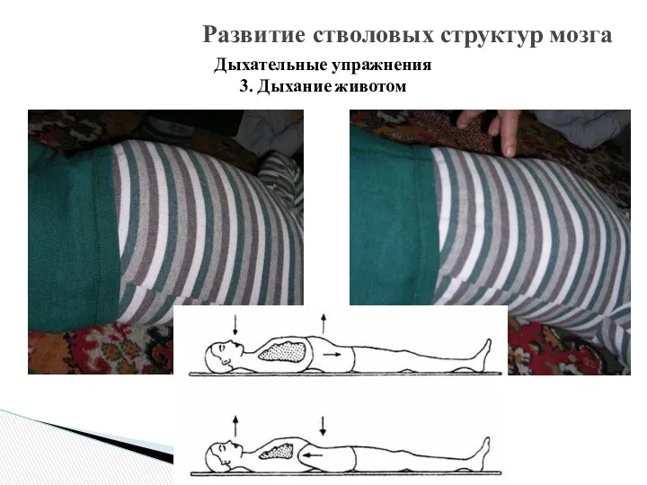 Развитие стволовых структур мозга Дыхательные упражнения 3. Дыхание животом