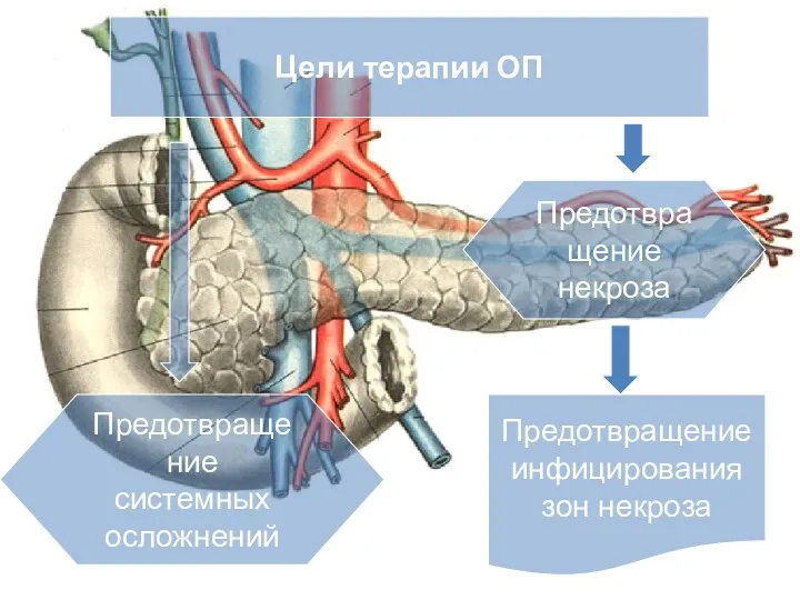 Цели терапии ОП Предотвращение системных осложнений Предотвращение некроза Предотвращение инфицирования зон некроза