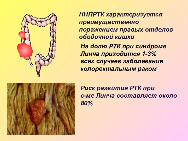 ННПРТК характеризуется преимущественно поражением правых отделов ободочной кишки На долю