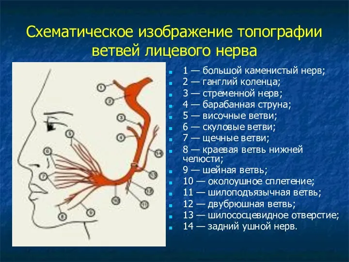 Схематическое изображение топографии ветвей лицевого нерва 1 — большой каменистый