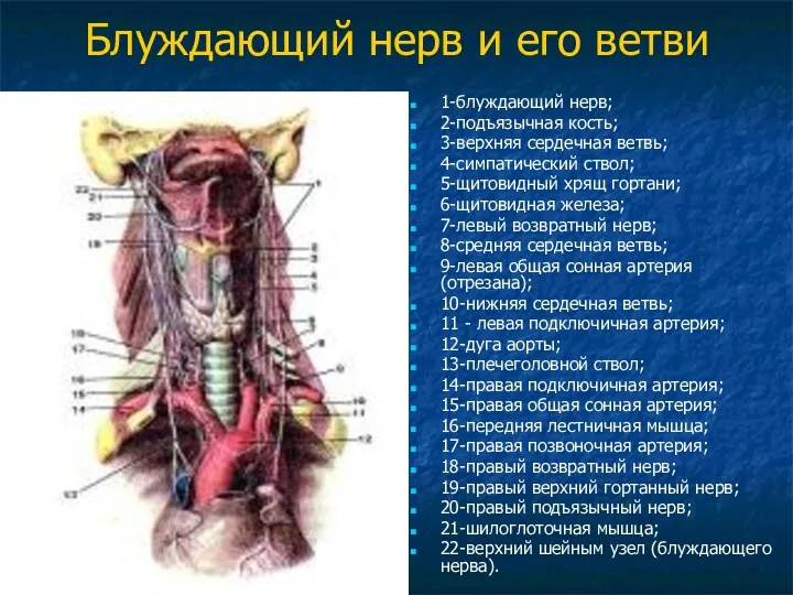 Блуждающий нерв и его ветви 1-блуждающий нерв; 2-подъязычная кость; 3-верхняя