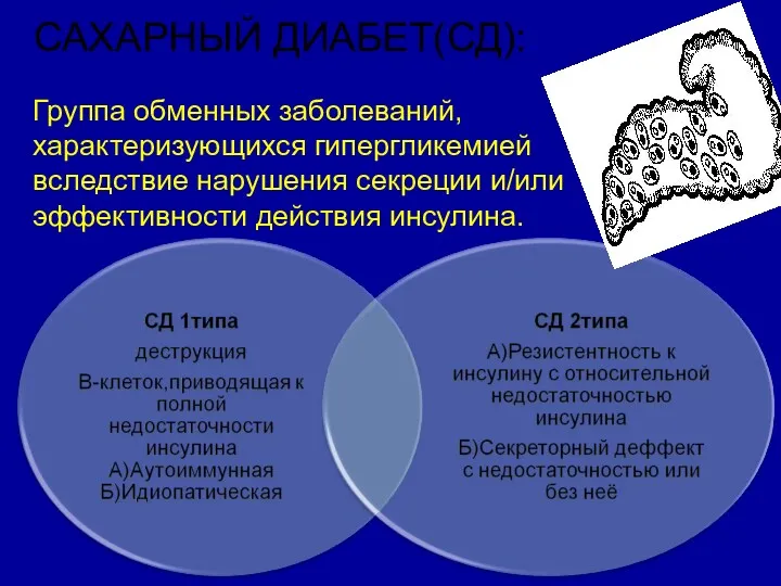 САХАРНЫЙ ДИАБЕТ(СД): Группа обменных заболеваний, характеризующихся гипергликемией вследствие нарушения секреции и/или эффективности действия инсулина.