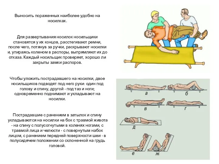 Выносить пораженных наиболее удобно на носилках. Для развертывания носилок носильщики