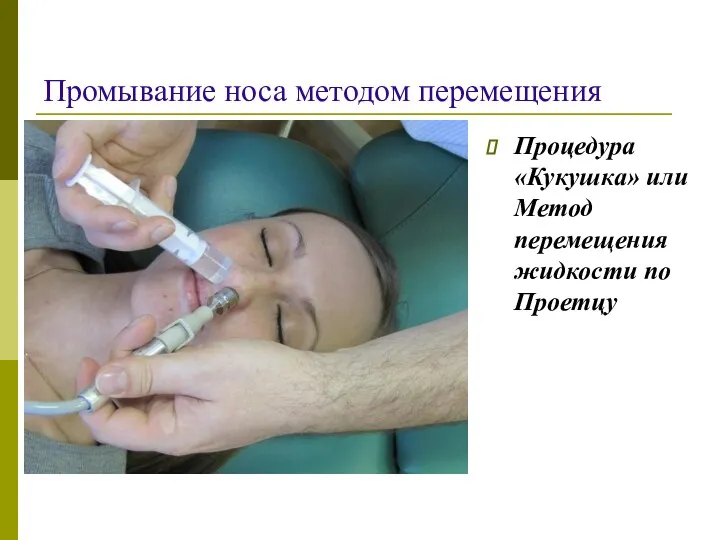 Промывание носа методом перемещения Процедура «Кукушка» или Метод перемещения жидкости по Проетцу