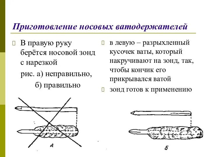 Приготовление носовых ватодержателей В правую руку берётся носовой зонд с